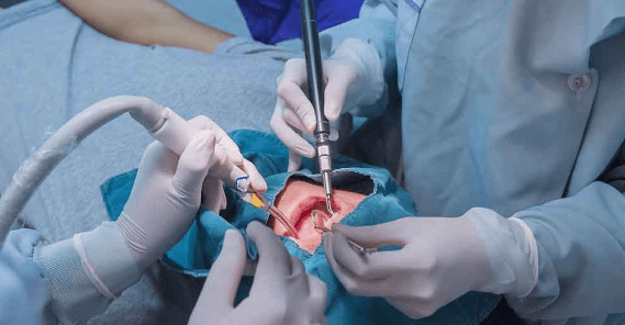 Maxillofacial Surgeon