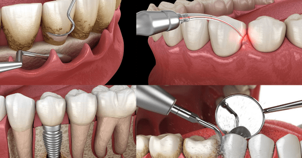 Periodontist